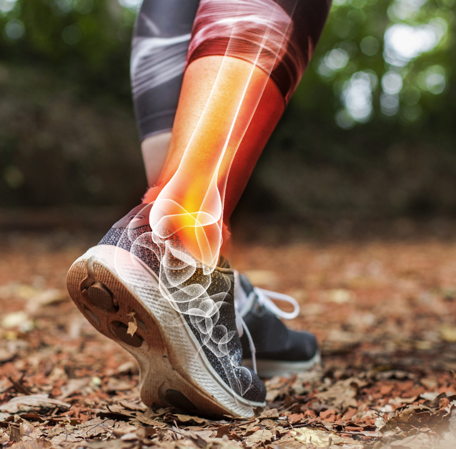 bild på ben med röntgen