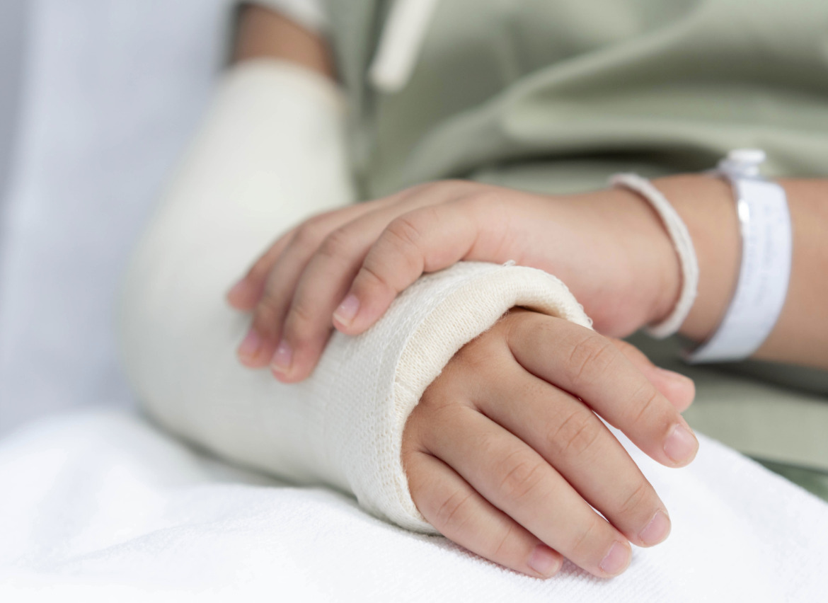 bild på person med bruten arm bild på person med bruten arm