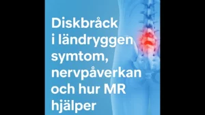 diskbråck i ländryggen thumbnail