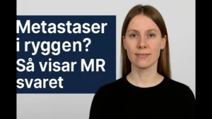 metastaser i ryggen thumbnail