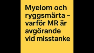 myelom och ryggsmärta thumbnail