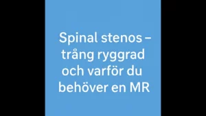 spinal stenos thumbnail