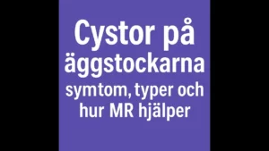 cystor på äggstockar thumbanil
