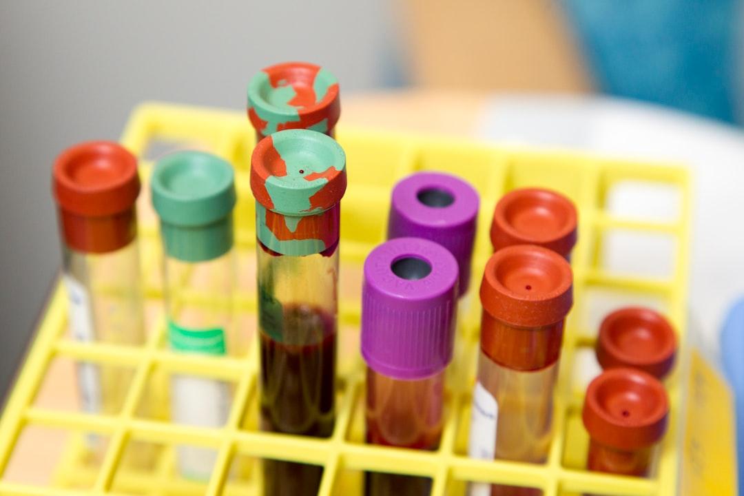 blood test
