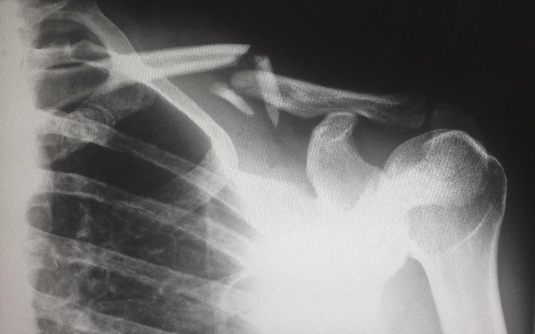 Shoulder injury
