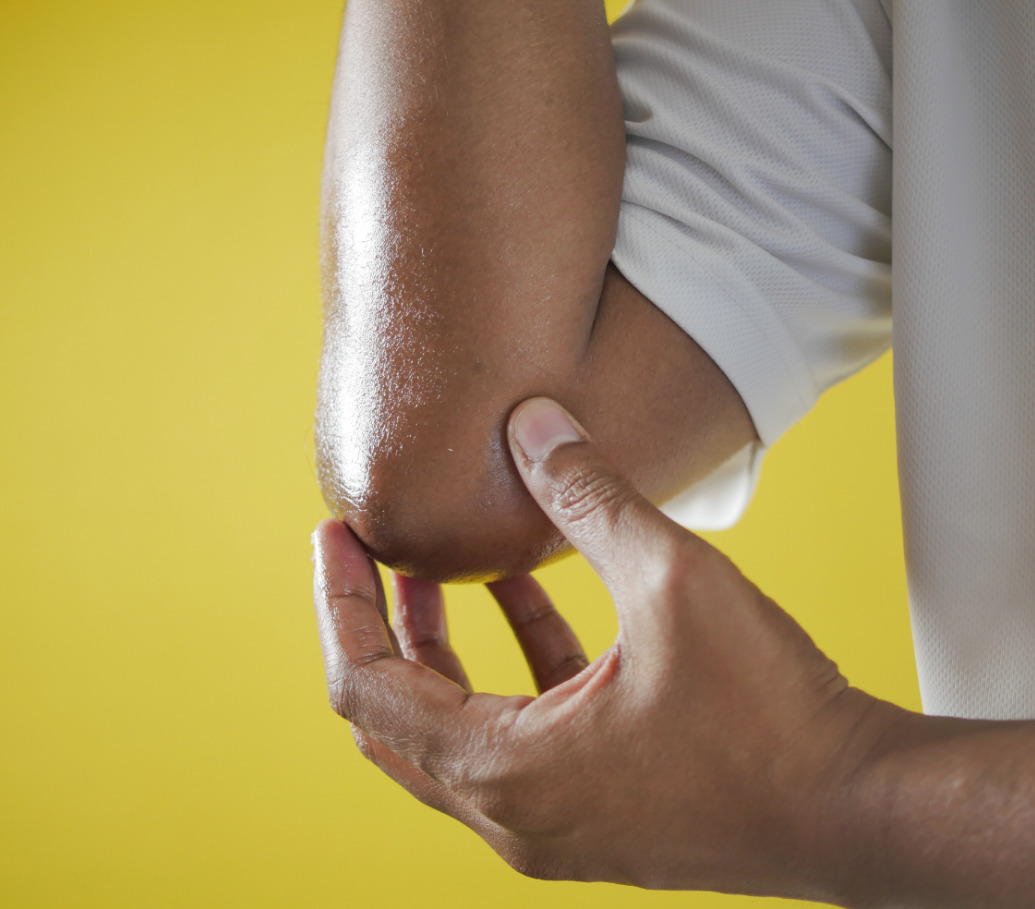 person med problem med armbågen