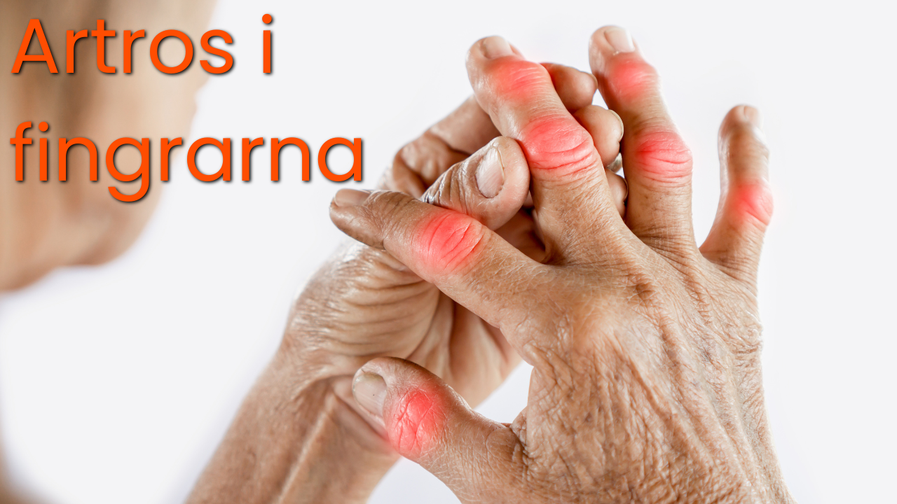 artros i fingrarna thumbnail