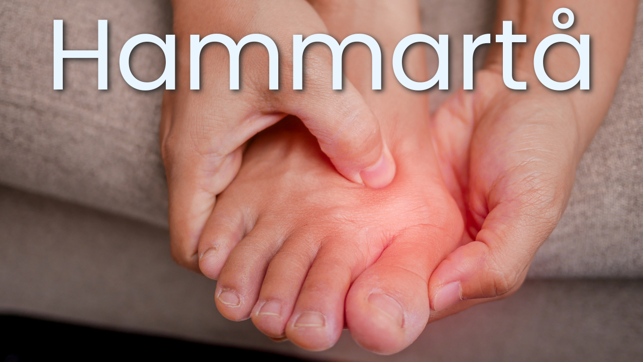hammartå thumbnail