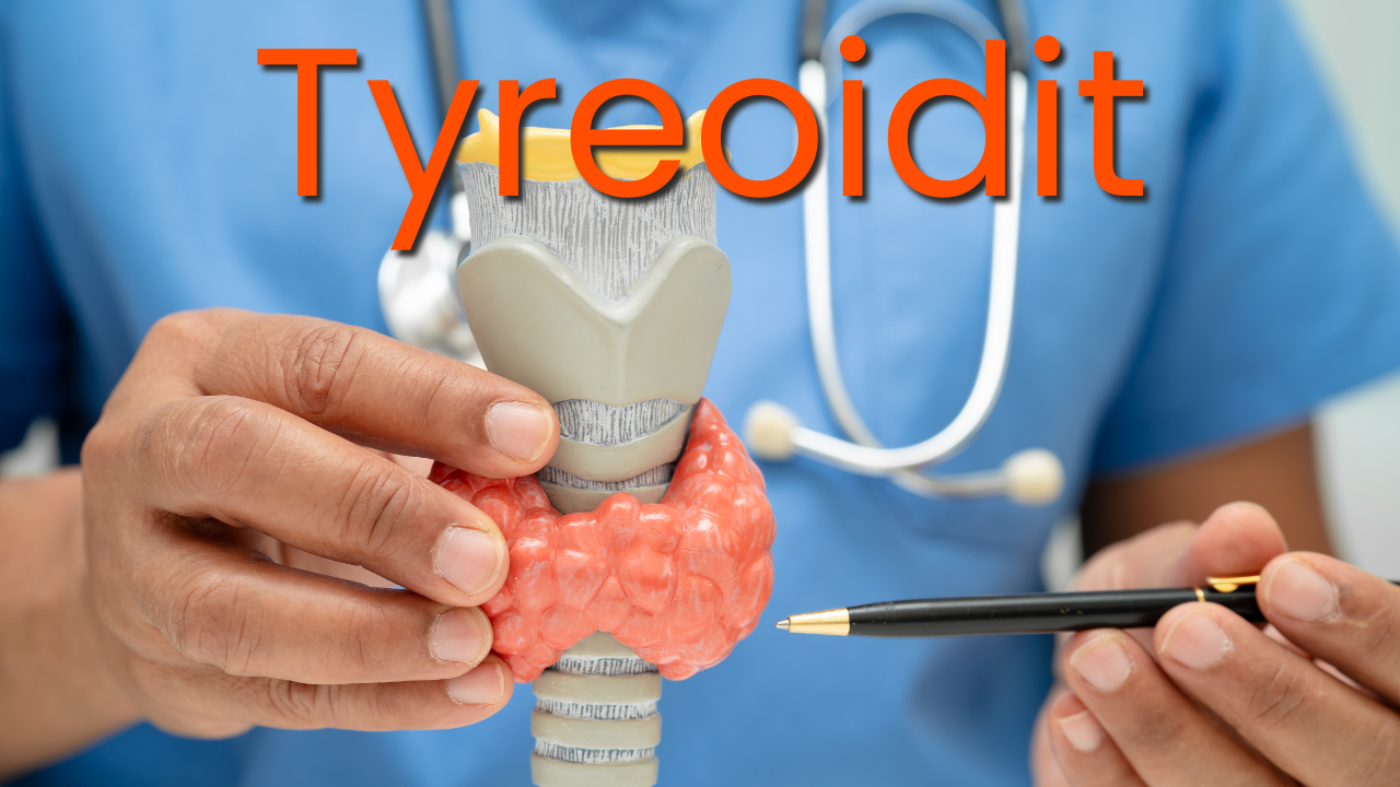 tyreoidit thumbnail