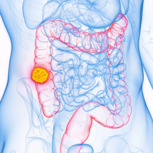 mr buk koloskopi cf 2026